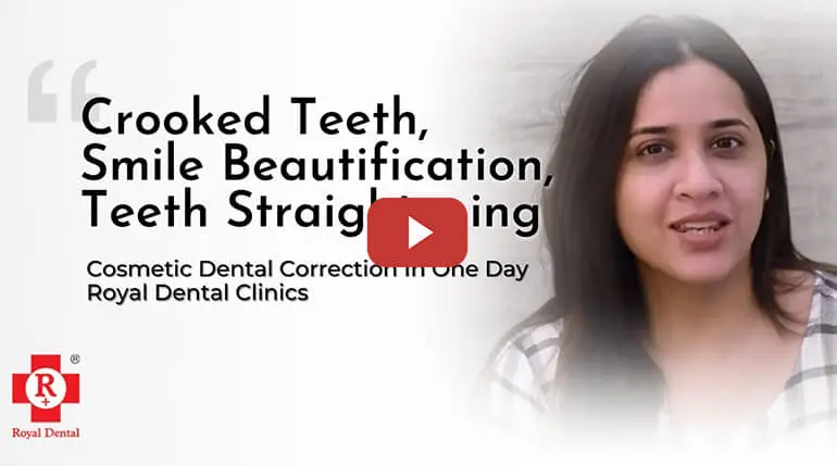 Cosmetic Dental Correction in One Day