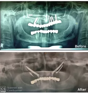 Dr Chirag Chamria | Oral Surgeon in Mumbai