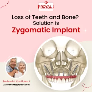 Zygomatic Dental Implant Treatment Mumbai