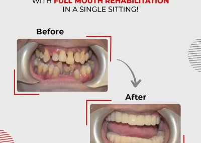 Best Dentist in Mumbai | Top Dentist in Kandivali