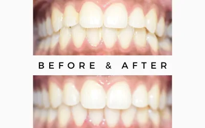 How modern Clinics are changing Smile?