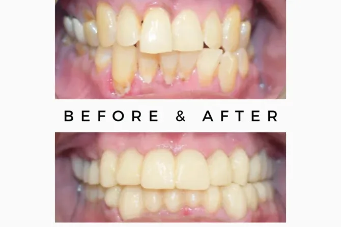 Cosmetic-Dentistry-670x446.png