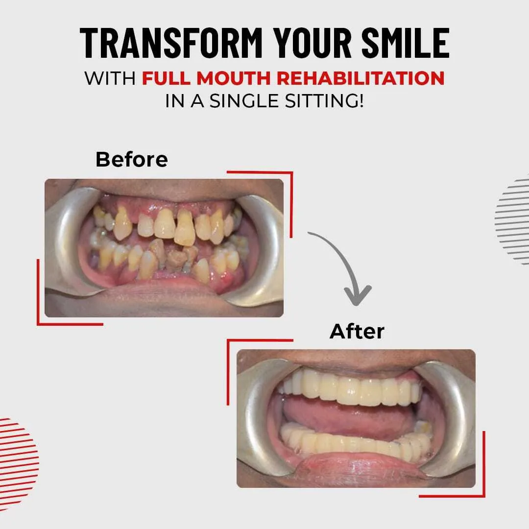 Transform-Your-Smile Best Dentist in Mumbai | Top Dentist in Kandivali