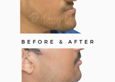 Before After Treatment | Jaw Pain
