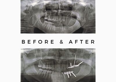 Best Oral Surgeon in Mumbai Kandivali