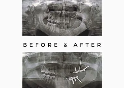 Best Oral Surgeon in Mumbai Kandivali