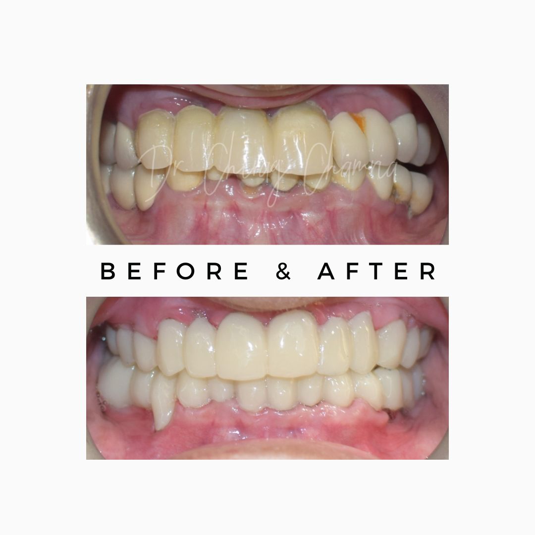 Oral Surgeon,dentist in mumbai,Oral Surgeon in Kandivali,Oral and Maxillofacial Surgeon Mumbai,Oral Surgery Clinic Kandivali,oral surgery,mouth doctor