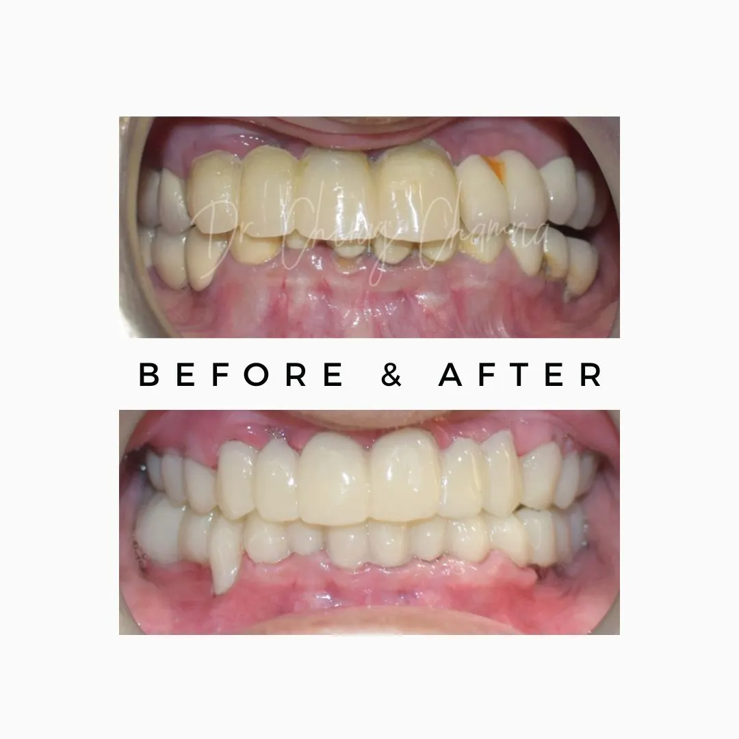 Oral Surgeon,dentist in mumbai,Oral Surgeon in Kandivali,Oral and Maxillofacial Surgeon Mumbai,Oral Surgery Clinic Kandivali,oral surgery,mouth doctor