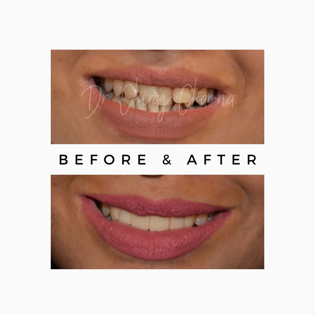 Oral Surgeon,dentist in mumbai,Oral Surgeon in Kandivali,Oral and Maxillofacial Surgeon Mumbai,Oral Surgery Clinic Kandivali,oral surgery,mouth doctor