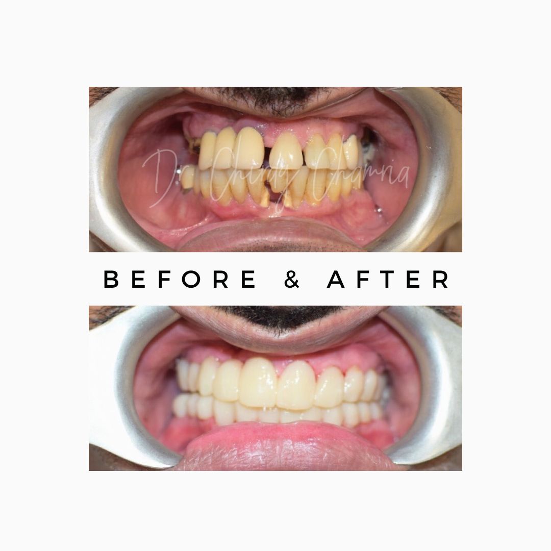 Cosmetic and Funcational Alignment