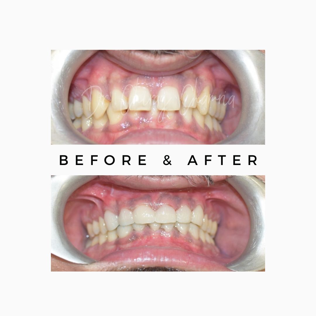 Oral Surgeon,dentist in mumbai,Oral Surgeon in Kandivali,Oral and Maxillofacial Surgeon Mumbai,Oral Surgery Clinic Kandivali,oral surgery,mouth doctor