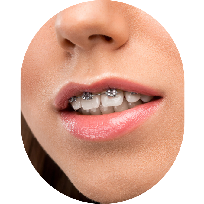 jaw pain,TMJ Treatment Mumbai,tmj specialist,TMJ Pain Specialist Kandivali,Jaw Pain Treatment Mumbai,Clicking jaw treatment Kandivali,Facial pain specialist,tekscan