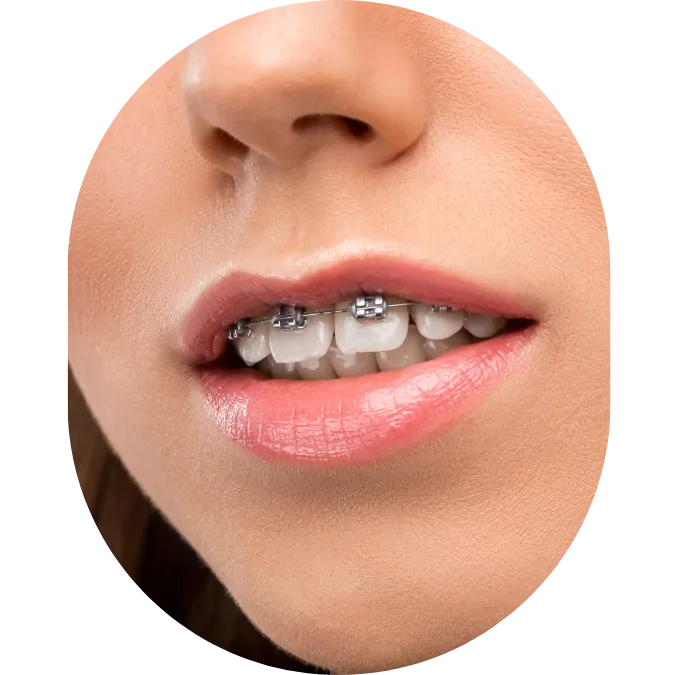 Oral Surgeon,dentist in mumbai,Oral Surgeon in Kandivali,Oral and Maxillofacial Surgeon Mumbai,Oral Surgery Clinic Kandivali,oral surgery,mouth doctor
