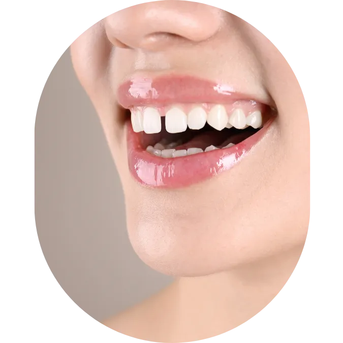 Oral Surgeon,dentist in mumbai,Oral Surgeon in Kandivali,Oral and Maxillofacial Surgeon Mumbai,Oral Surgery Clinic Kandivali,oral surgery,mouth doctor