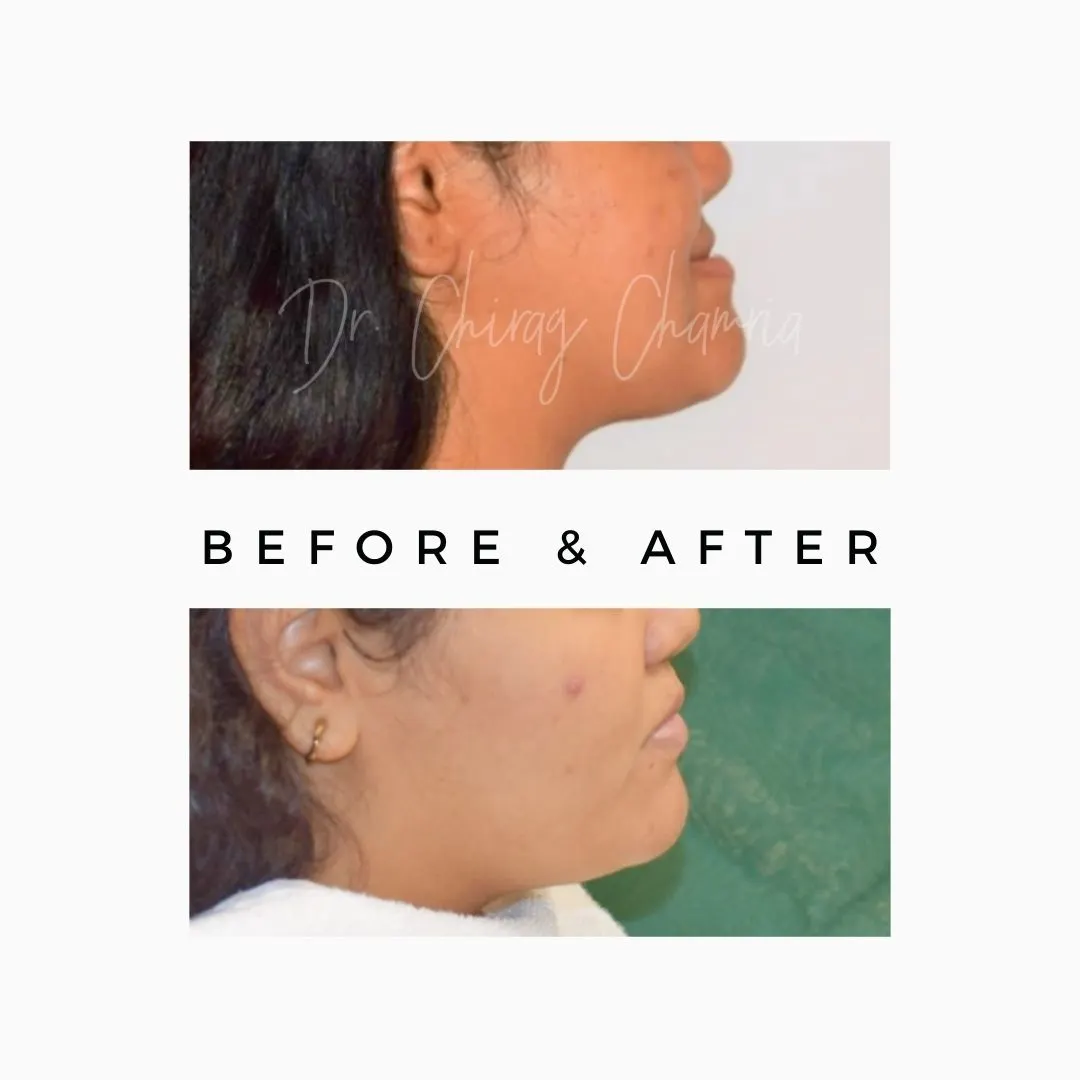 Oral Surgeon,dentist in mumbai,Oral Surgeon in Kandivali,Oral and Maxillofacial Surgeon Mumbai,Oral Surgery Clinic Kandivali,oral surgery,mouth doctor