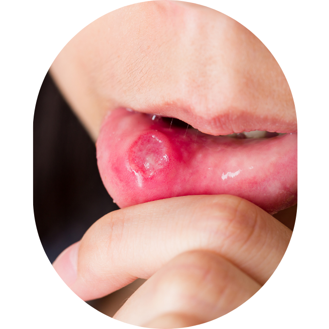 jaw pain,TMJ Treatment Mumbai,tmj specialist,TMJ Pain Specialist Kandivali,Jaw Pain Treatment Mumbai,Clicking jaw treatment Kandivali,Facial pain specialist,tekscan