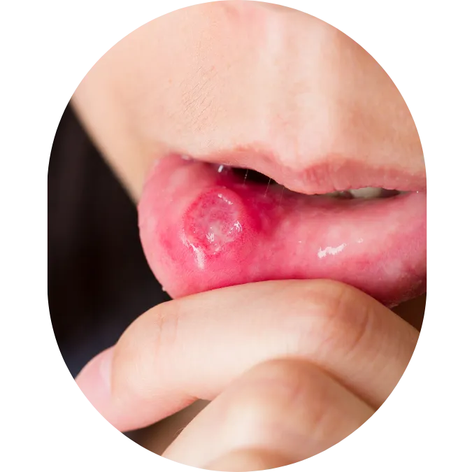 Oral Surgeon,dentist in mumbai,Oral Surgeon in Kandivali,Oral and Maxillofacial Surgeon Mumbai,Oral Surgery Clinic Kandivali,oral surgery,mouth doctor