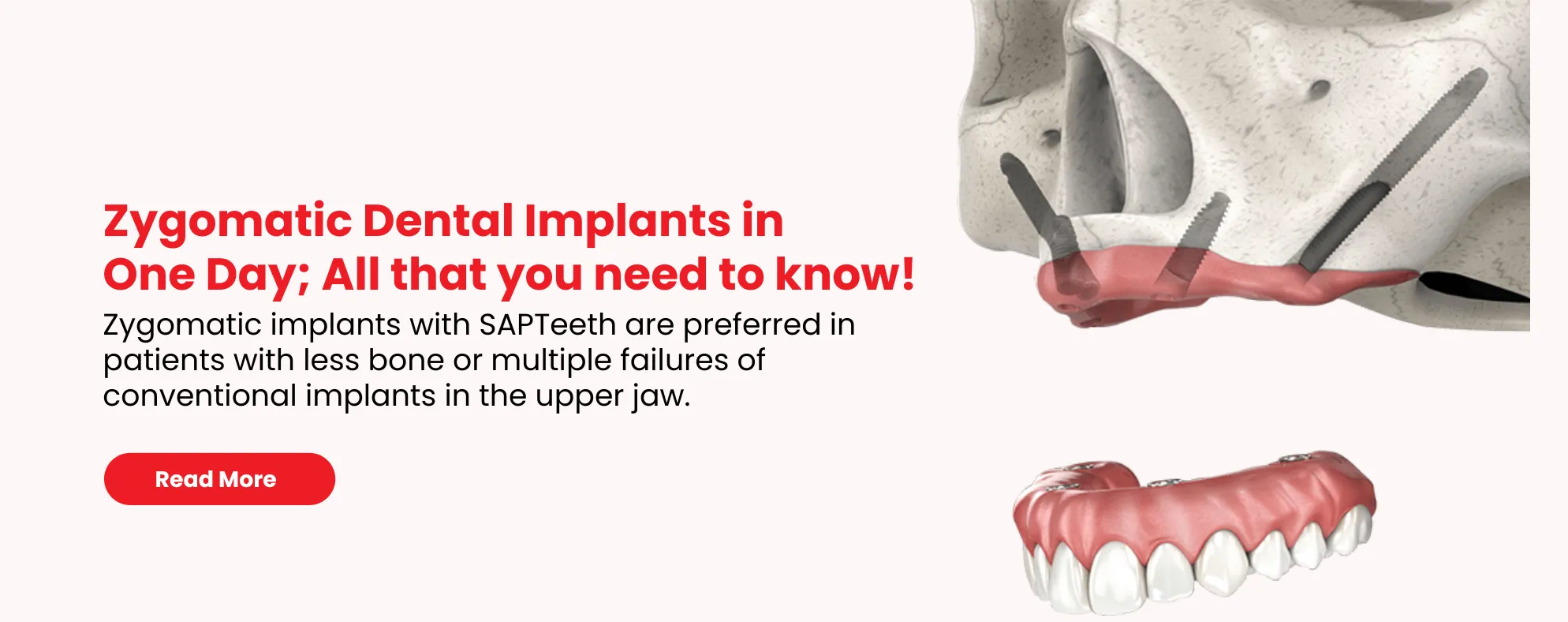 permanent teeth