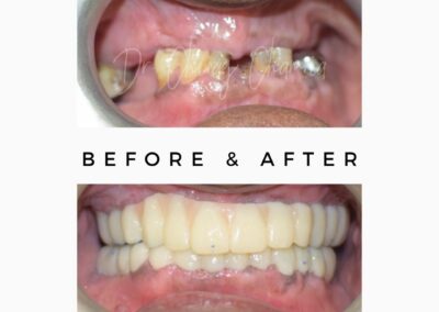 Oral and Maxillofacial Surgery Dental Clinic in Kandivali