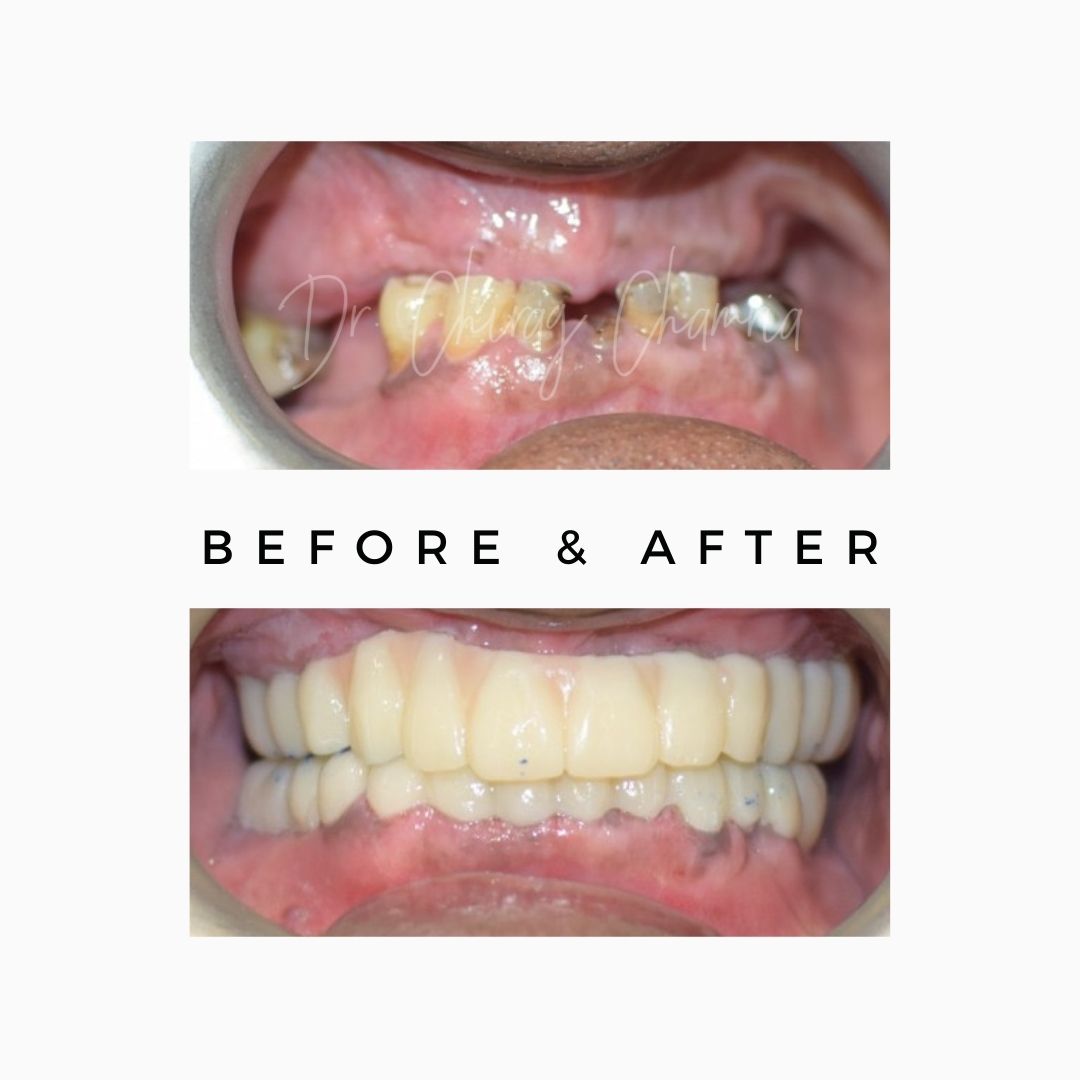 Oral Surgeon,dentist in mumbai,Oral Surgeon in Kandivali,Oral and Maxillofacial Surgeon Mumbai,Oral Surgery Clinic Kandivali,oral surgery,mouth doctor