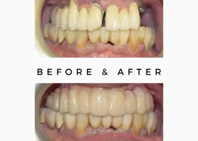 Oral and Maxillofacial Surgeon Dental Clinic in Kandivali