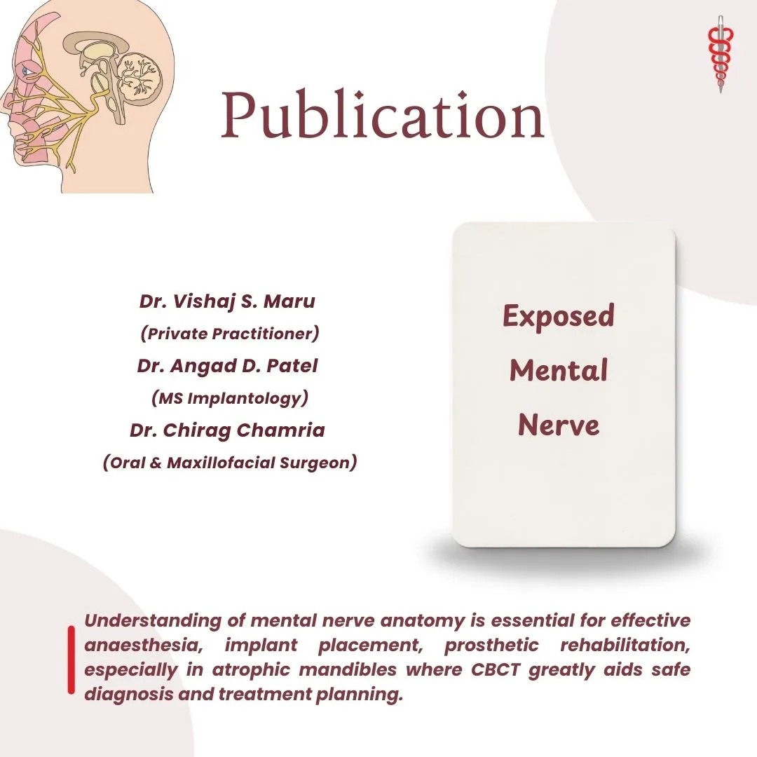 Mental nerve Dr Chirag Chamria