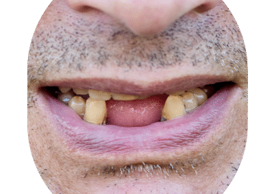 Oral and Maxillofacial Surgeon Dental Clinic in Kandivali