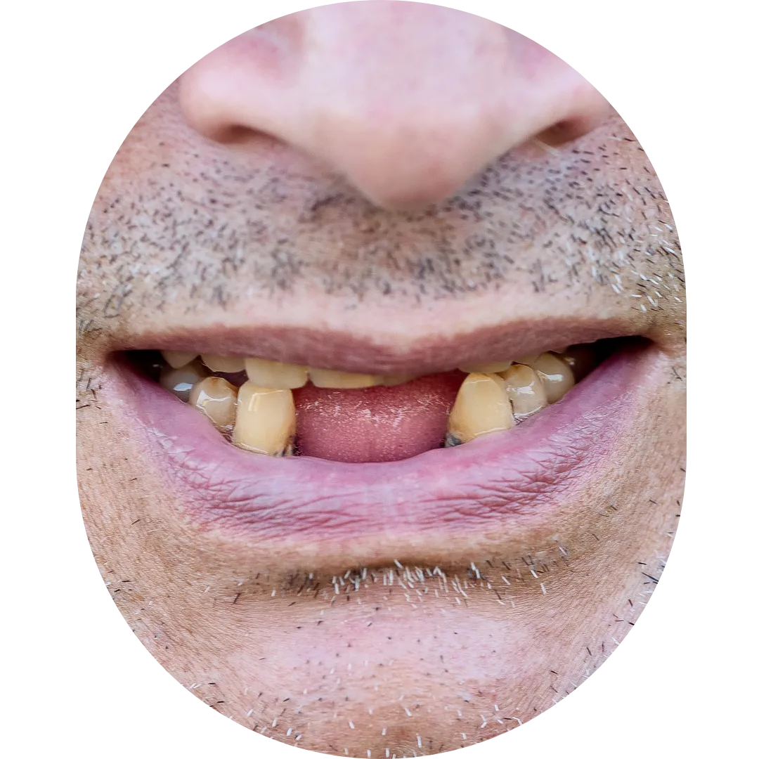 Oral Surgeon,dentist in mumbai,Oral Surgeon in Kandivali,Oral and Maxillofacial Surgeon Mumbai,Oral Surgery Clinic Kandivali,oral surgery,mouth doctor