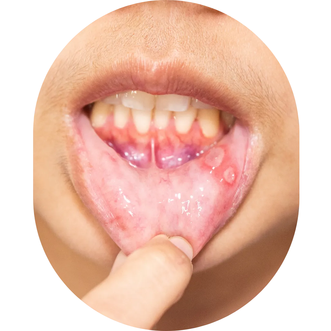 Oral Surgeon,dentist in mumbai,Oral Surgeon in Kandivali,Oral and Maxillofacial Surgeon Mumbai,Oral Surgery Clinic Kandivali,oral surgery,mouth doctor