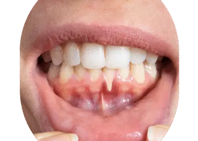 Oral and Maxillofacial Surgeon Dental Clinic in Kandivali