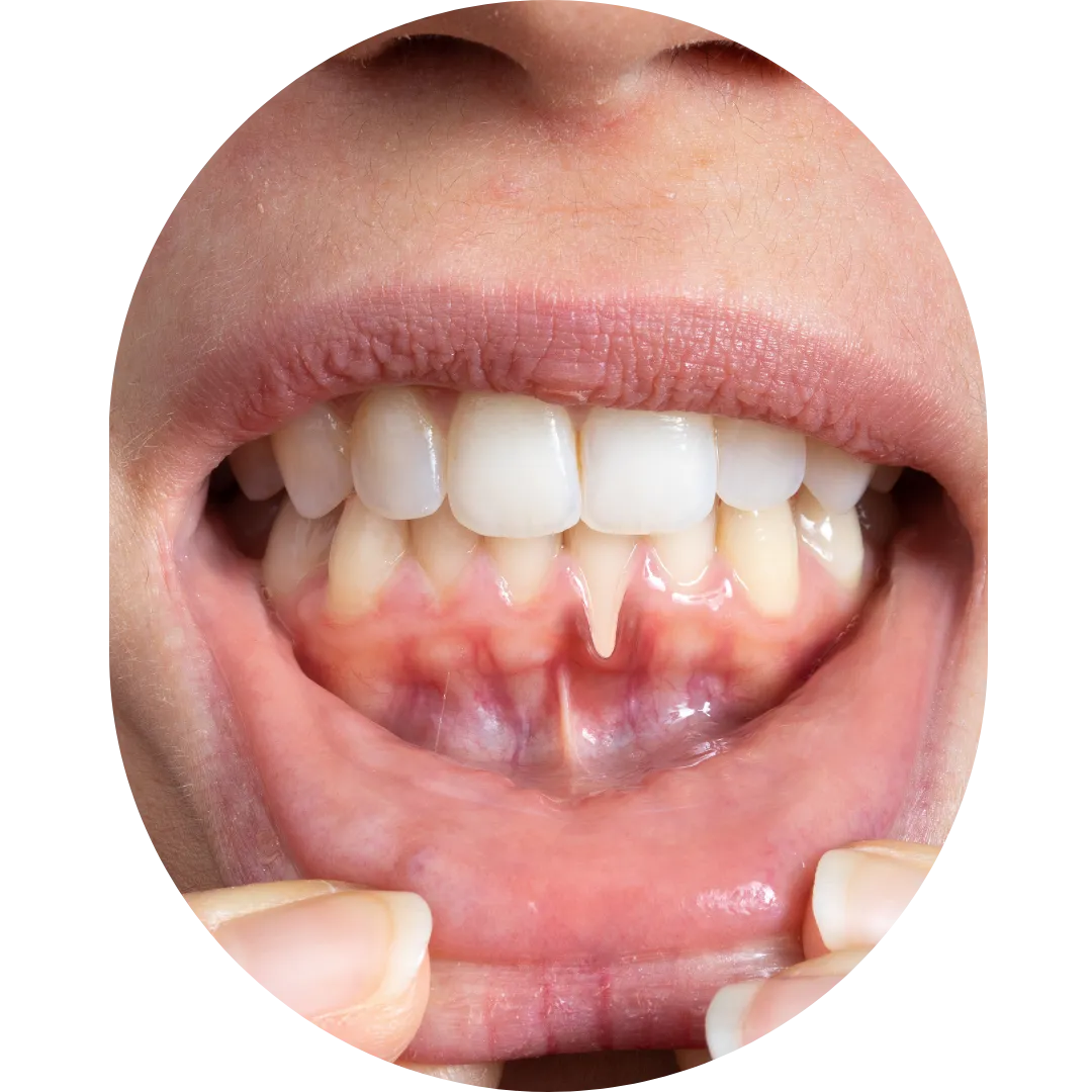 Oral Surgeon,dentist in mumbai,Oral Surgeon in Kandivali,Oral and Maxillofacial Surgeon Mumbai,Oral Surgery Clinic Kandivali,oral surgery,mouth doctor