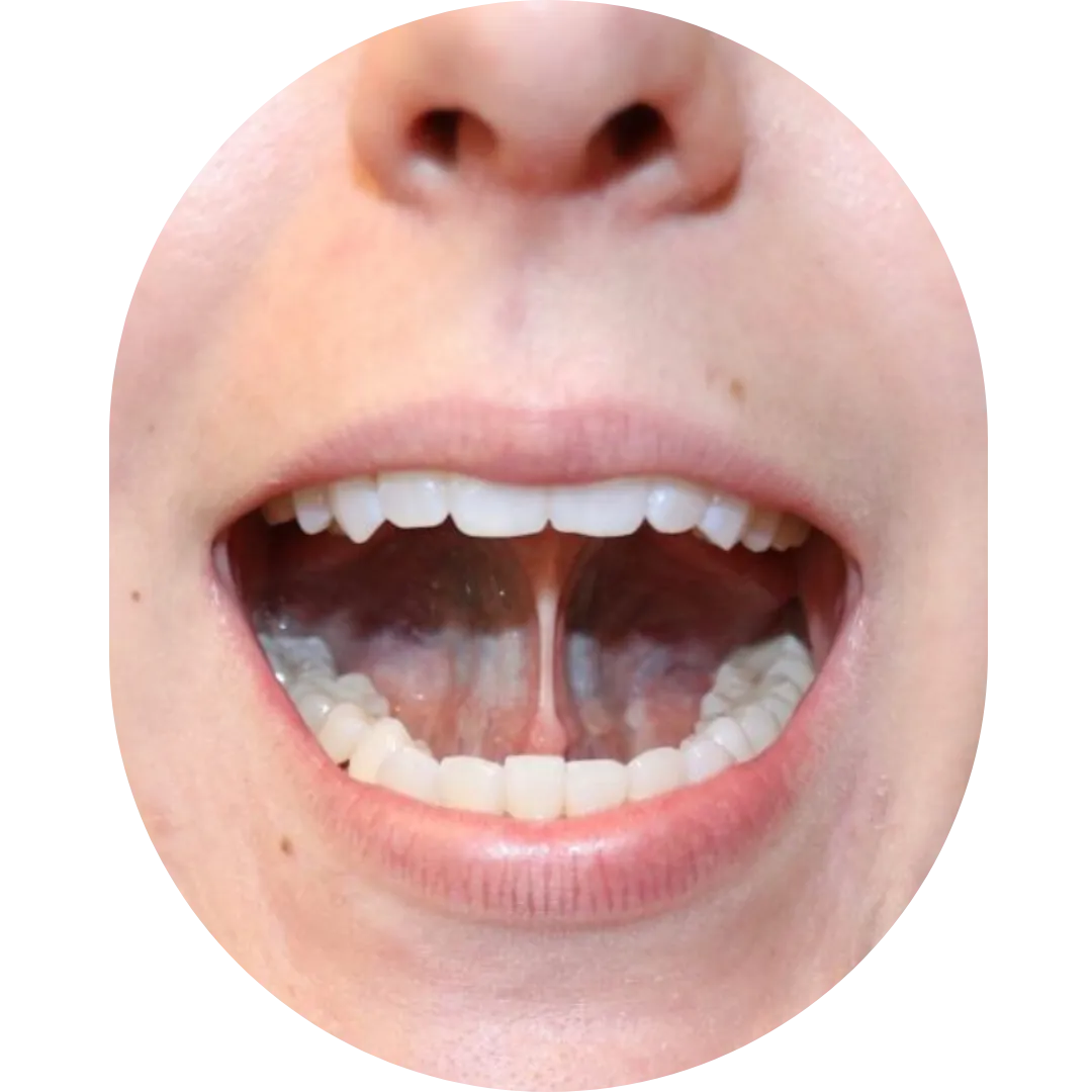 Oral Surgeon,dentist in mumbai,Oral Surgeon in Kandivali,Oral and Maxillofacial Surgeon Mumbai,Oral Surgery Clinic Kandivali,oral surgery,mouth doctor