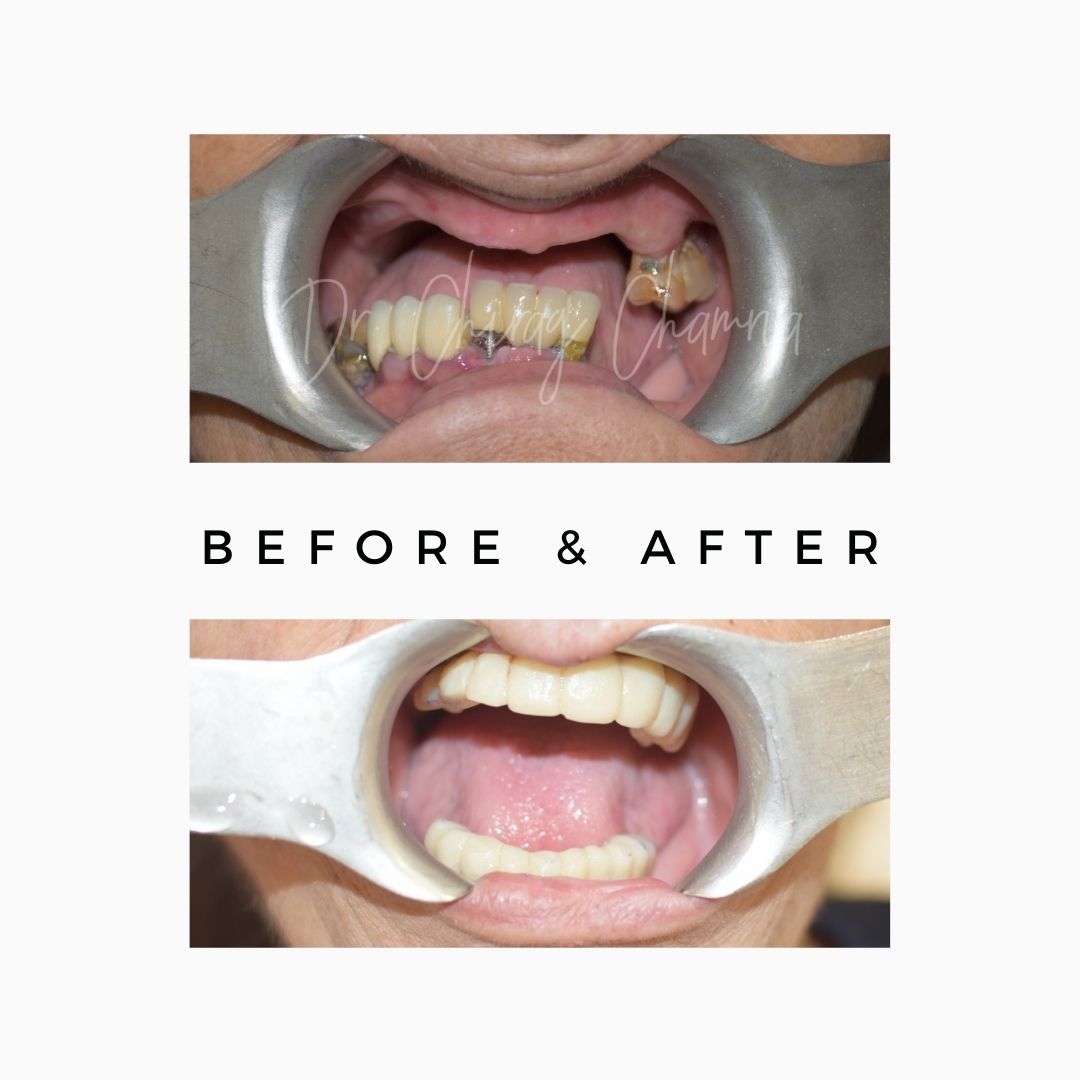 Oral Surgeon,dentist in mumbai,Oral Surgeon in Kandivali,Oral and Maxillofacial Surgeon Mumbai,Oral Surgery Clinic Kandivali,oral surgery,mouth doctor