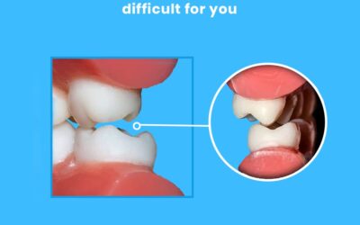 Corrective Jaw Surgery: Oral Surgeons Fix Bite Problems