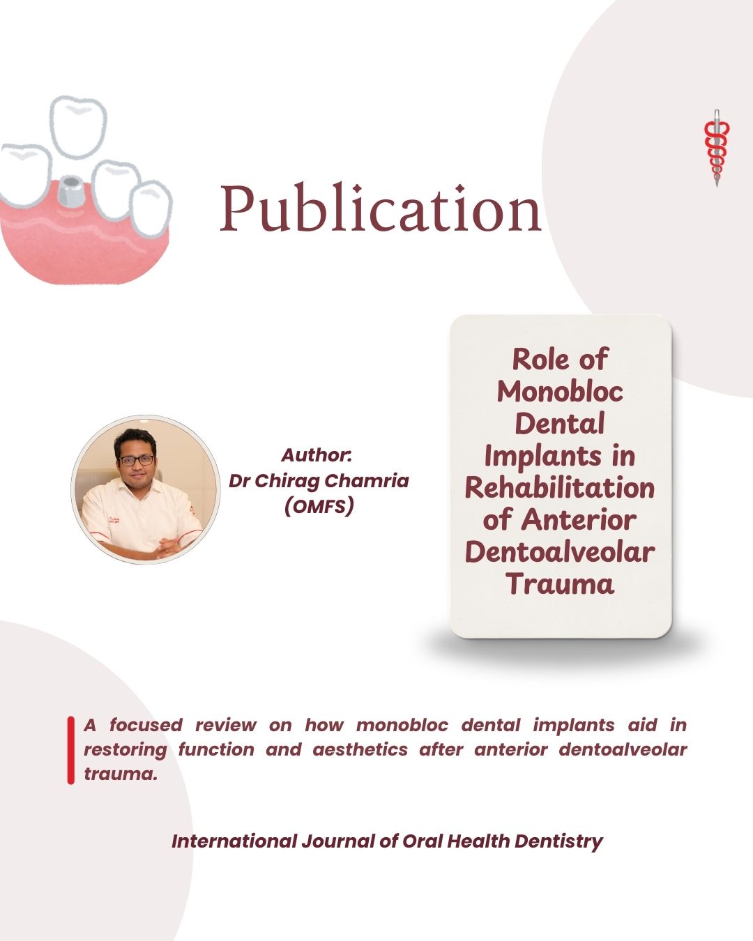 Dr Chirag Publication - Monobloc Dental Implants
