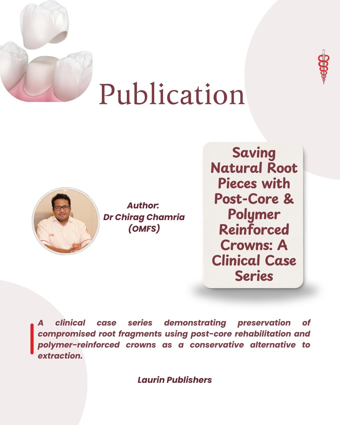 Dr Chirag Publication - Saving Natural Root Pieces