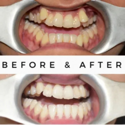 Oral Surgeon,dentist in mumbai,Oral Surgeon in Kandivali,Oral and Maxillofacial Surgeon Mumbai,Oral Surgery Clinic Kandivali,oral surgery,mouth doctor