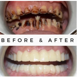 Oral Surgeon,dentist in mumbai,Oral Surgeon in Kandivali,Oral and Maxillofacial Surgeon Mumbai,Oral Surgery Clinic Kandivali,oral surgery,mouth doctor