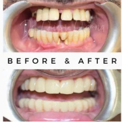 Oral Surgeon,dentist in mumbai,Oral Surgeon in Kandivali,Oral and Maxillofacial Surgeon Mumbai,Oral Surgery Clinic Kandivali,oral surgery,mouth doctor