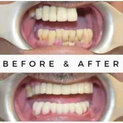 Oral Surgeon,dentist in mumbai,Oral Surgeon in Kandivali,Oral and Maxillofacial Surgeon Mumbai,Oral Surgery Clinic Kandivali,oral surgery,mouth doctor