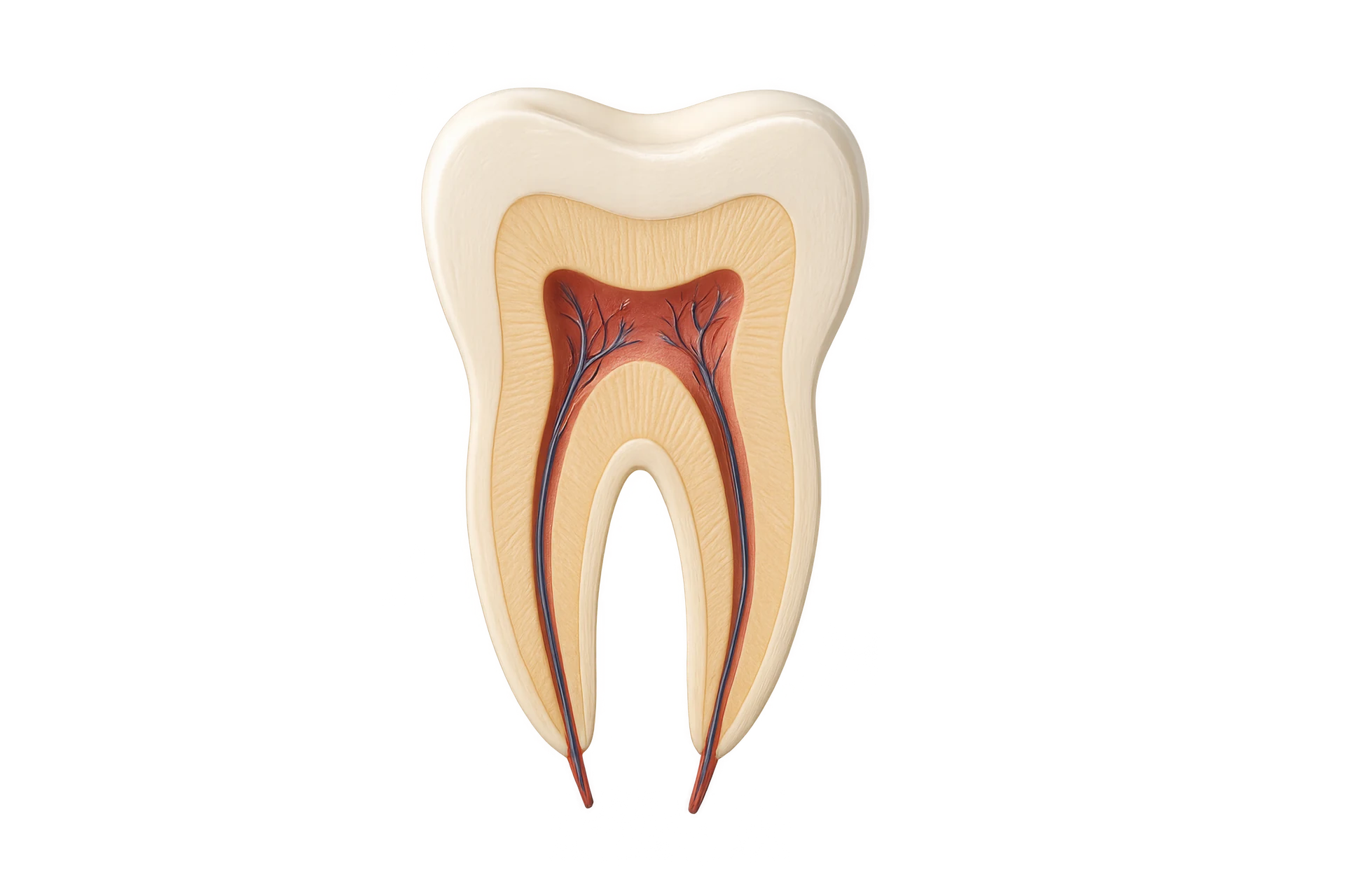 single sitting root canal treatment