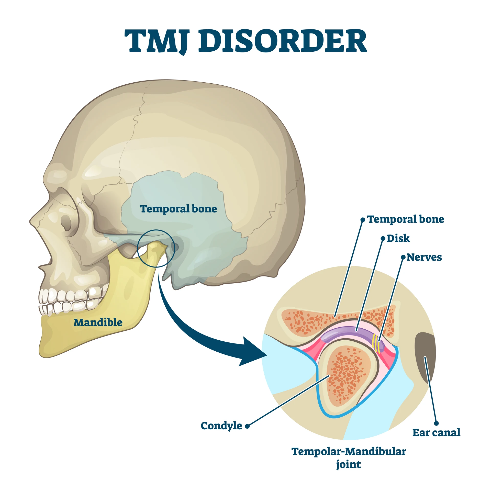 How Is TMD Diagnosed? Examination, MRI, CBCT and Finding the Real Cause