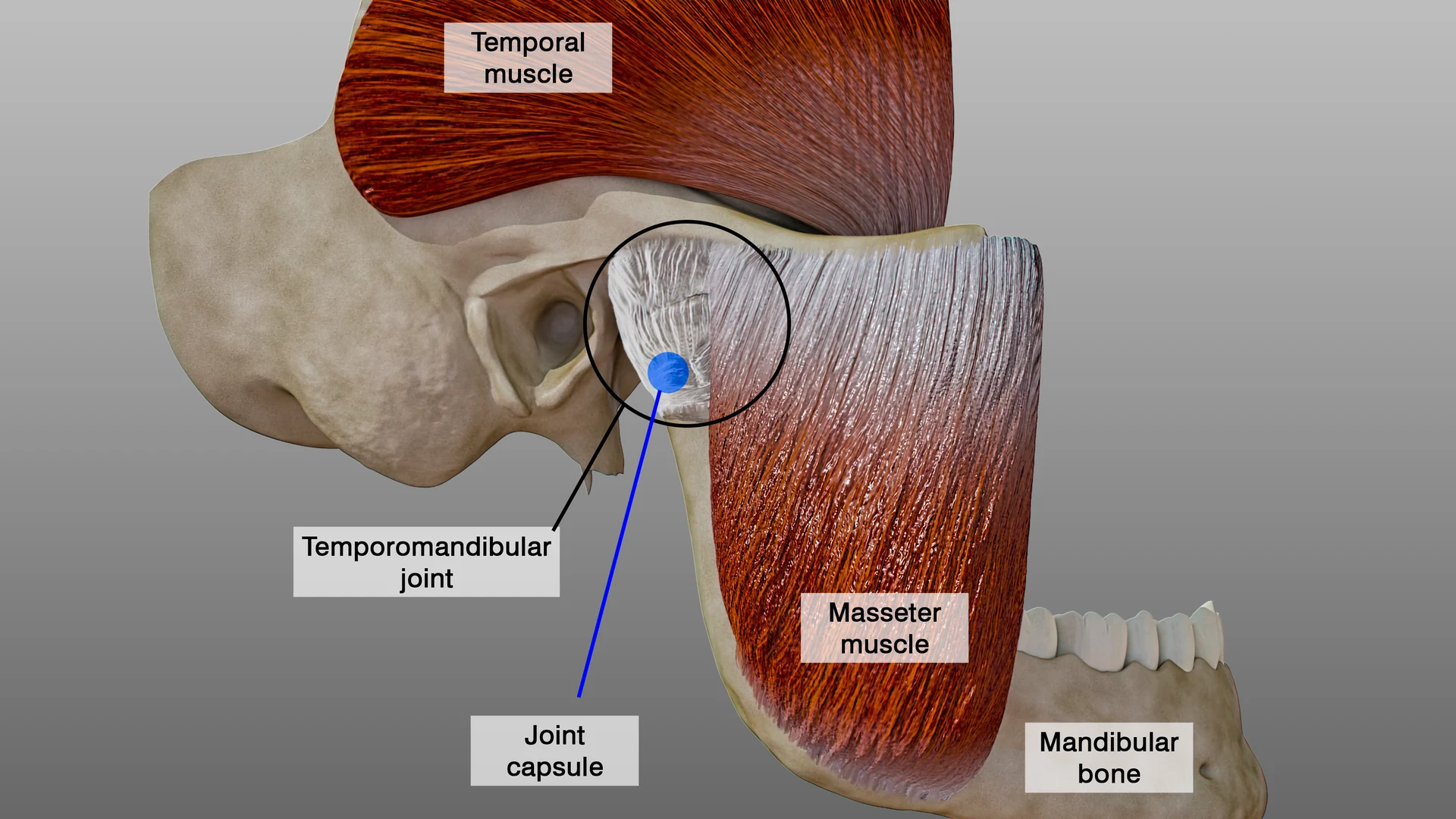 Can Your Bite Cause TMJ Pain? Crowns, Clenching, Bruxism and Occlusion Explained